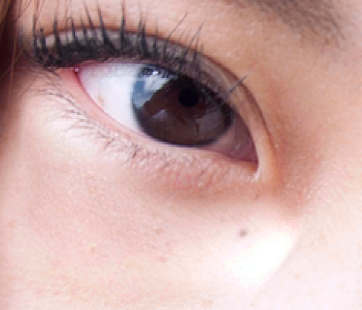 Contour inférieur de l’œil gauche corrigé dans PS CC 2014 à l’aide de l’outil Pièce